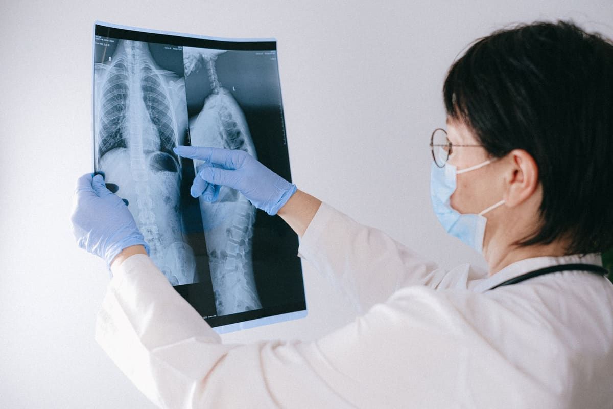 A physician in a white coat, mask, and blue gloves holds up front and side X-ray films of a patient's spine and points to a level in the middle of the back.